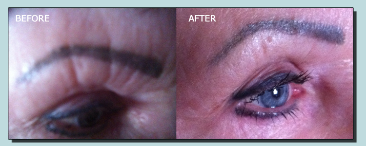 Vals Before and After